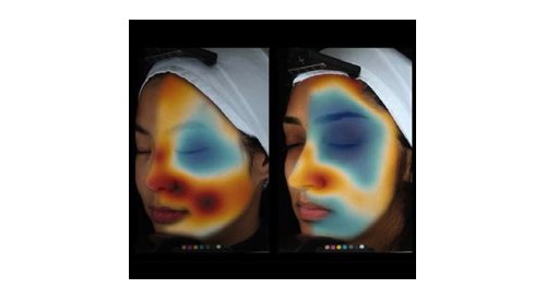 DSM quantifies stratum corneum variations in different skin ethnicities